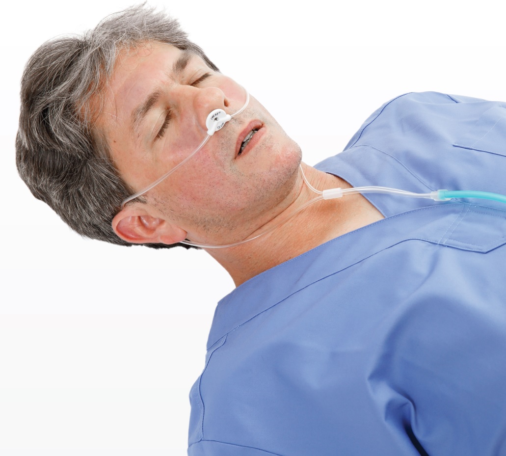 iWay - Advanced nasopharyngeal airway patency efficient oxygenation and accurate capnography on patient